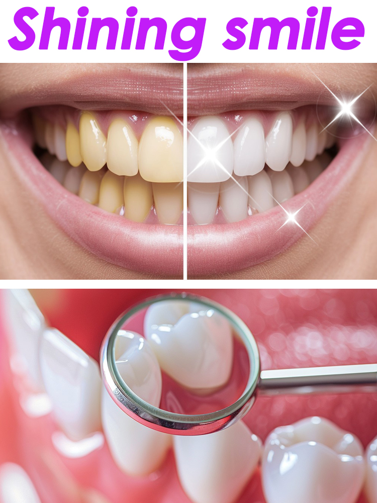 Teeth Whitening Xylitol - GlorySmile Teeth Whitening Fruity Toothpaste Products