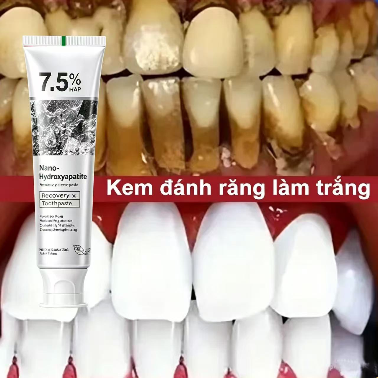 Teeth Whitening Toothpaste - 7.5% Hydroxyapatite Probiotic Whitening Toothpaste Enamel