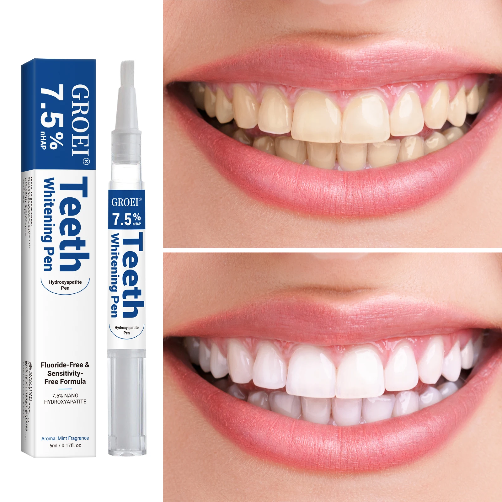 Hydroxyapatite Tooth Whitening - Teeth Whitening With Hydrogen Peroxide review and price