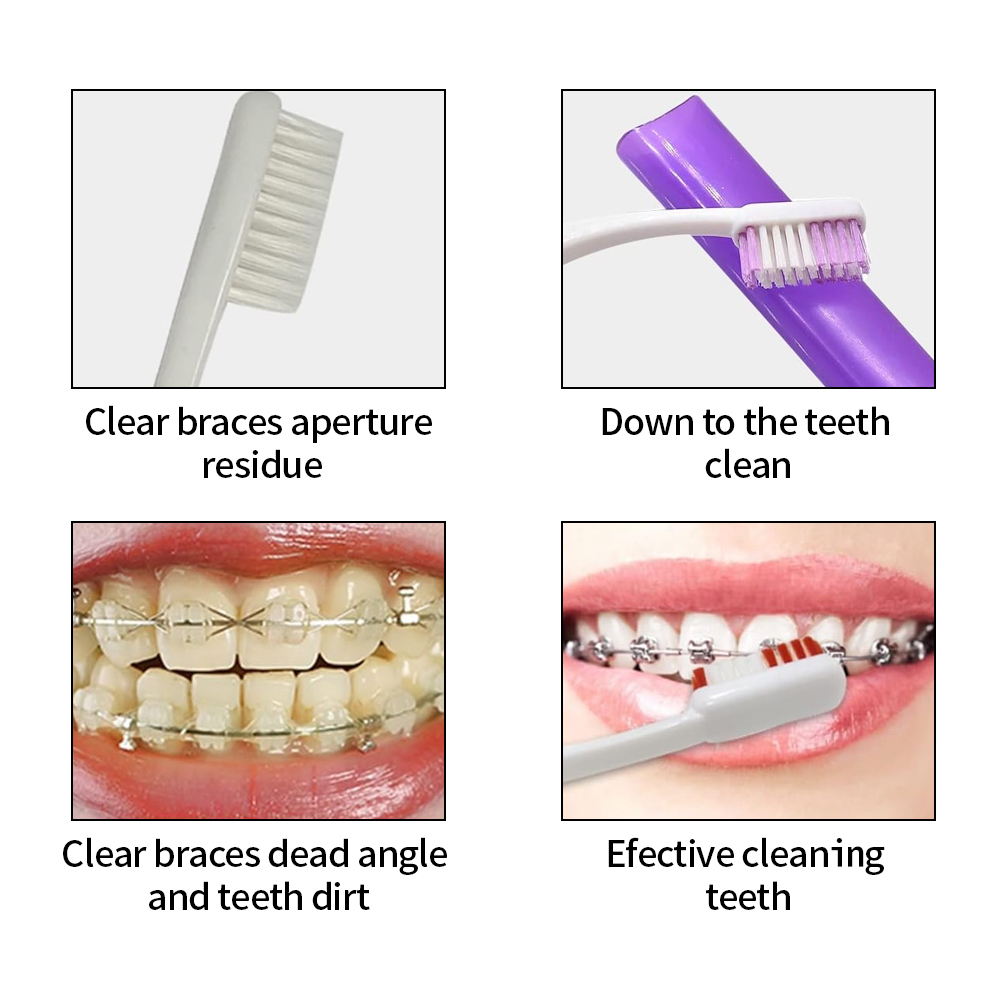 8Pcs/set Orthodontic Dental Ca - Teeth Whitening Brush review and price