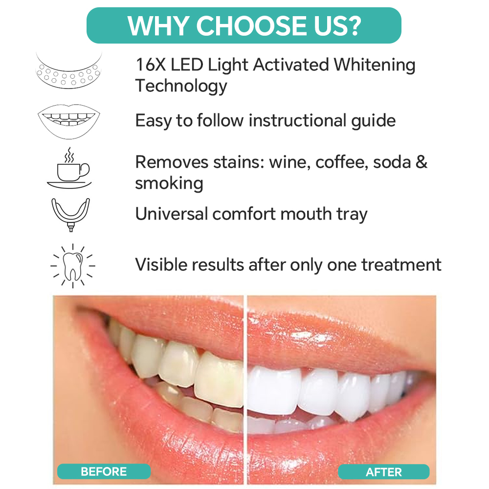 Teeth Whitening Enhancer Light - Led Mouth Tray review and price
