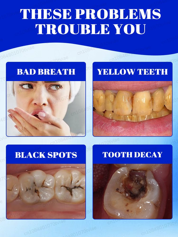 Whitening toothpaste and miner - Teeth Whitening Effects review and price