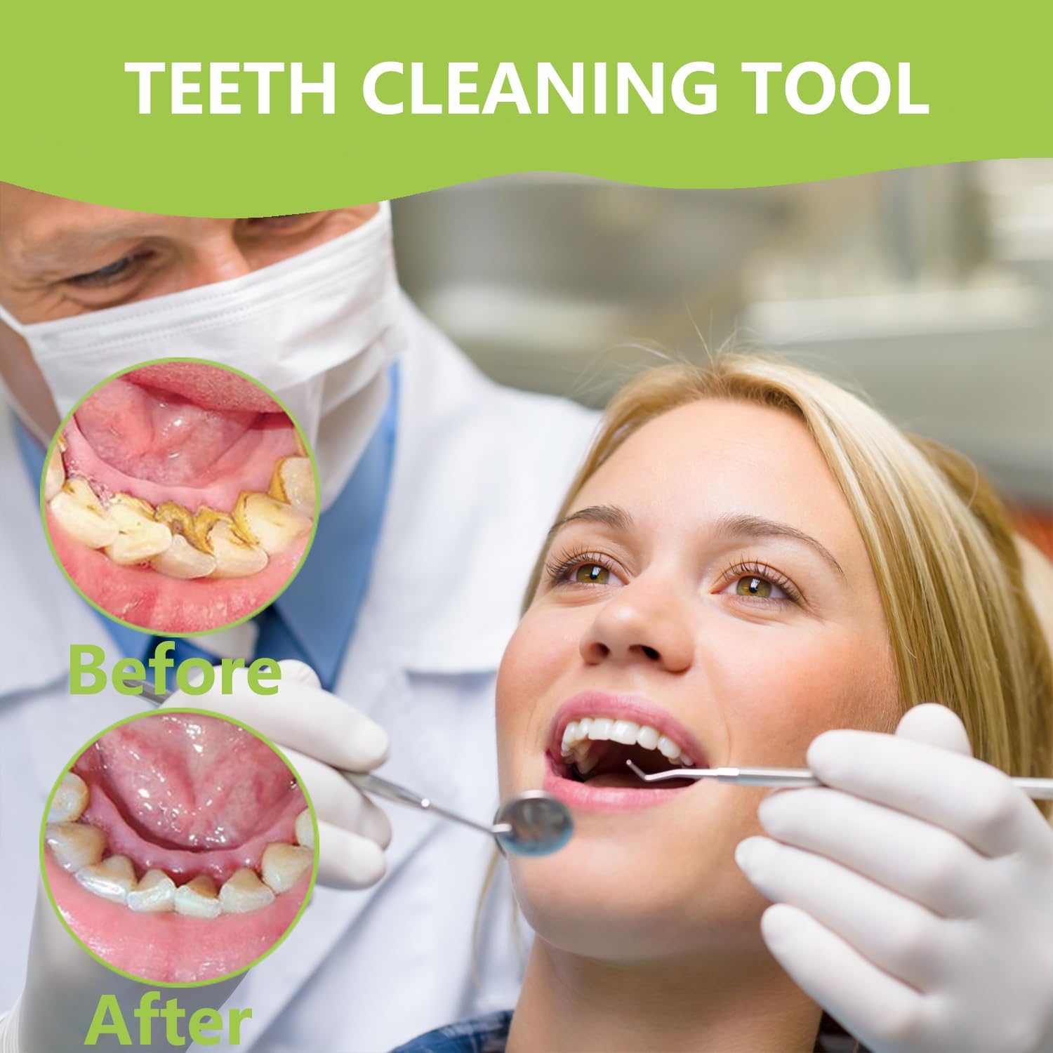 Professional Teeth Cleaning Or - Teeth Whitening Machine Professional review and price
