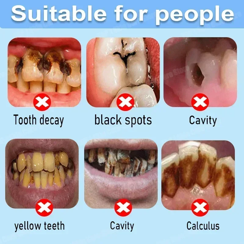 Anti Decay Toothpaste Repairs  - Teeth Whitening Uv review and price
