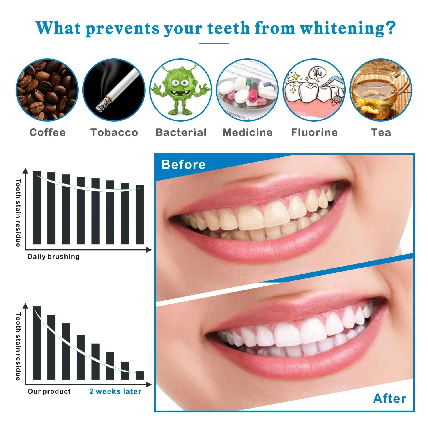 14/28pcs 3D Teeth Whitening St - Teeth Whitening Effects review and price