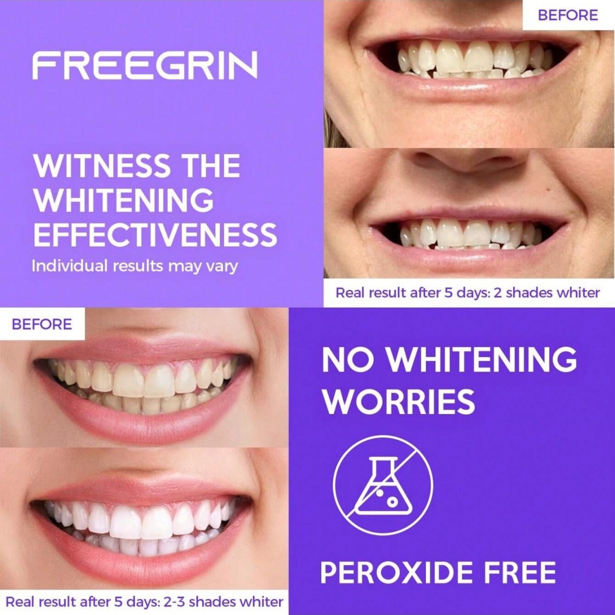 Deluxe Whitening Teeth Sticker - Teeth Whitening With Hydrogen Peroxide review and price