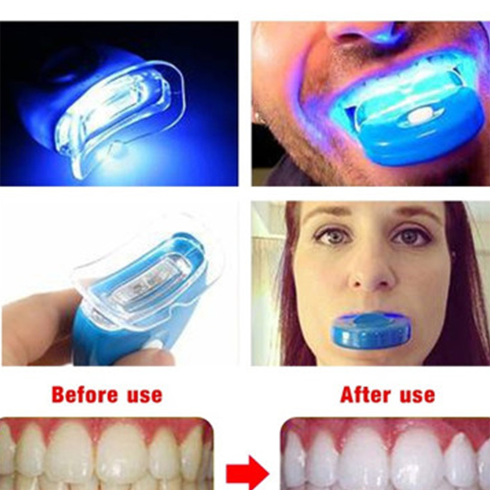 New Blue Led Teeth Whitening A - Teeth Whitening With Laser review and price