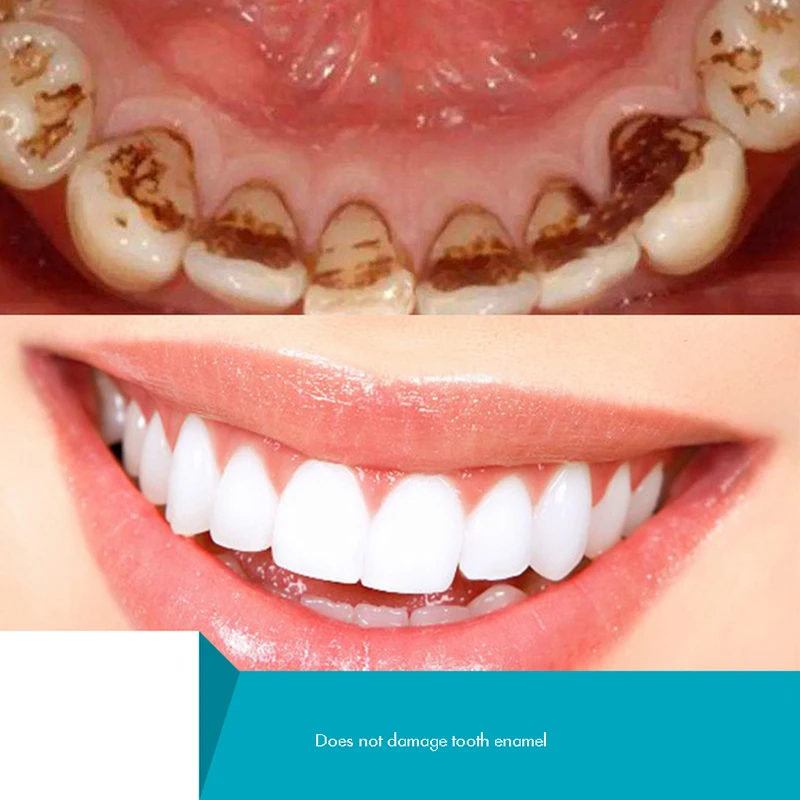 Herbal Tooth Powder, Natural T - Teeth Whitening Xylitol review and price