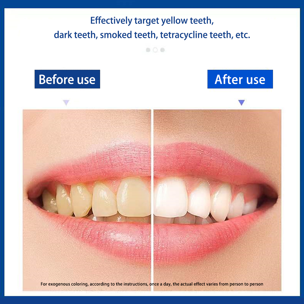 70/140 Pairs 5D White Teeth Wh - Teeth Whitening Effects review and price