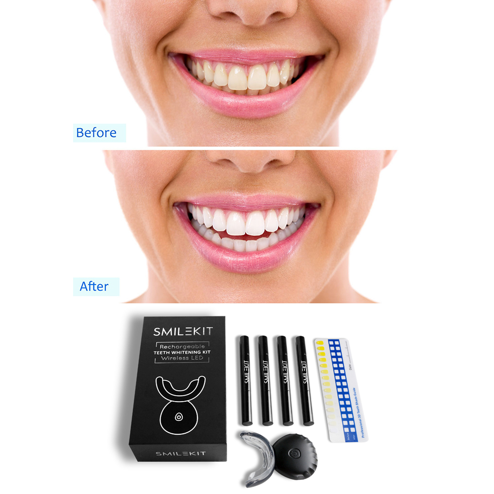 New Electric Teeth Whitening L - Teeth Whitening Led Kit review and price