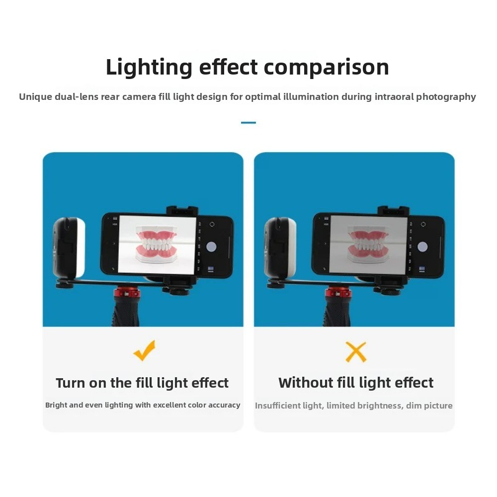 Dental Photography Light, Blue - Teeth Whitening Led Kit review and price