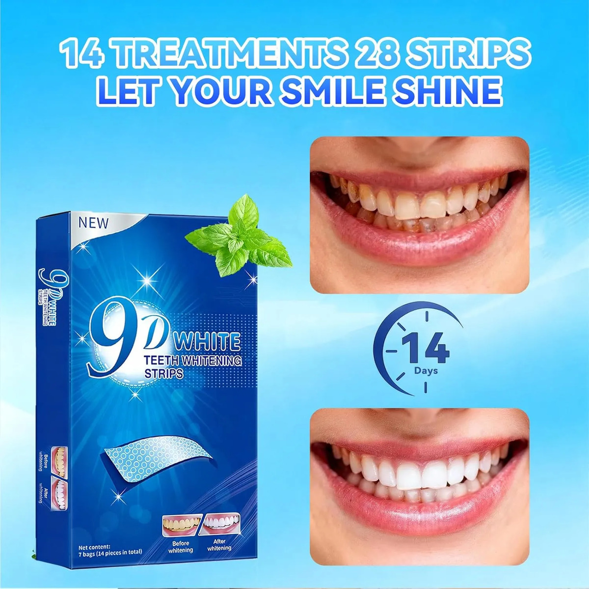 Teeth Whitening Strips - 9D Te - Teeth Whitening Effects review and price