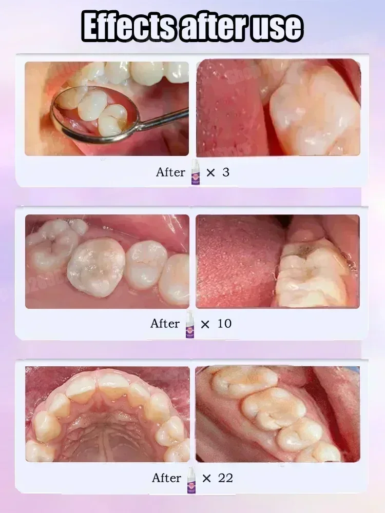 Teeth Cleaning Toothpaste Remo - Teeth Whitening Toothpaste review and price