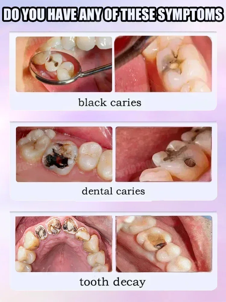 Teeth Cleaning Toothpaste Remo - Teeth Whitening Toothpaste review and price